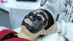 BM27 Nd:YAG Laser – Precision Tattoo & Pigmentation Removal | Professional Treatment Demo
