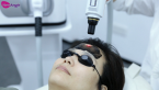 How to Operate the Latest YAG Laser Machine | Tattoo Removal & Carbon Peeling Guide