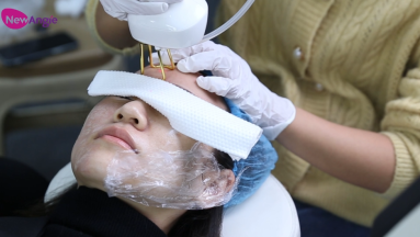 Achieve Radiant Complexion: How Does Professional CO2 Fractional Laser Work?