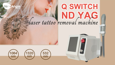 Nd YAG Laser Carbon Peeling for Deep Skin Rejuvenation
