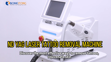 How to use nd yag laser tattoo removal machine to remove tattoos painlessly