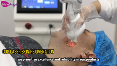 Professional Co2 Laser Equipment:Advanced Skin Rejuvenation System